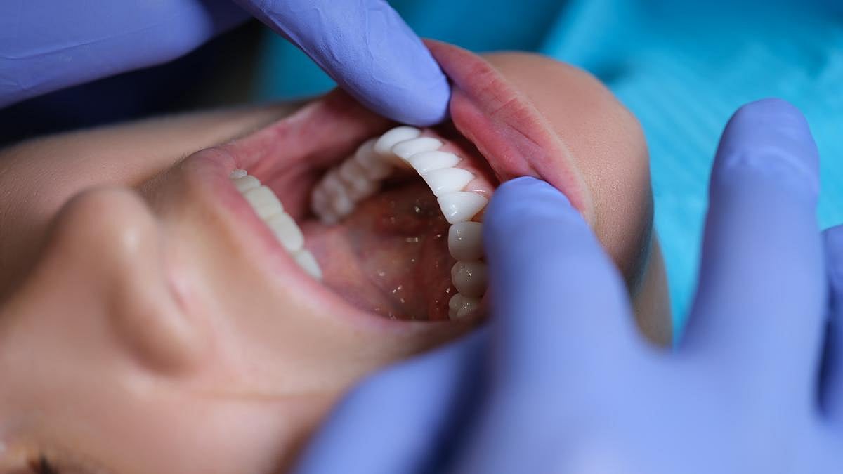 Oral Bacteria, Fungi Linked to Increased Risk for Pancreatic Cancer
