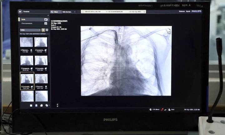 Se mantienen enfermedades vasculares como la principal causa de muerte en el mundo