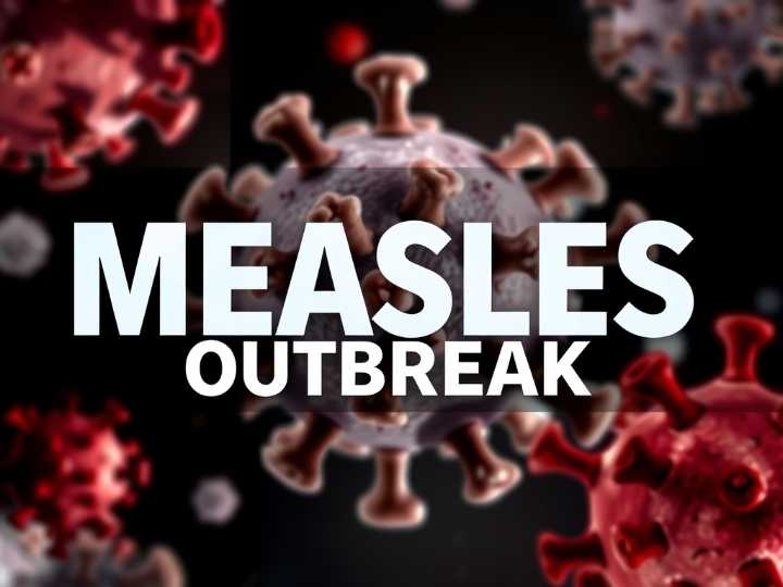 Three New Measles Cases Hit Georgia As Outbreak Spreads