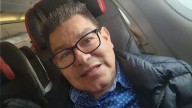 "Pensé que era leve": Dilbert Aguilar sufre accidente antes de presentación y será sometido a delicada operación