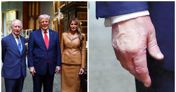 Trump, 79, Bids Farewell to King Charles With a Makeup
