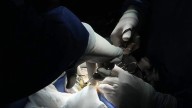 Donación de médula ósea y sangre de cordón umbilical puede salvar vidas: Secretaría de Salud