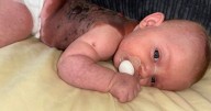 Extremely rare and beautiful Plymouth baby has surgery