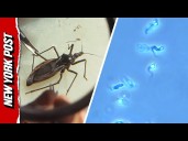 What is Chagas Disease? The Scary Truth About the ‘Kissing Bug’ PARASITE Spreading in the US
