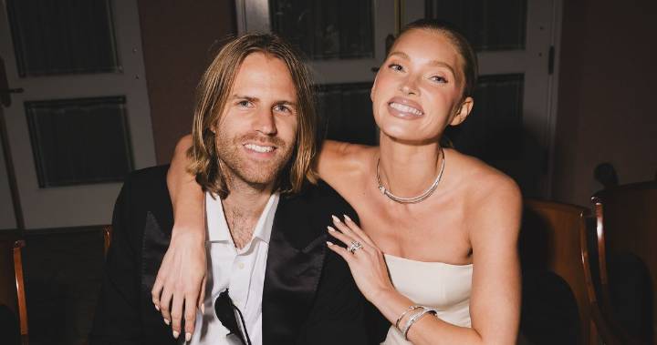Elsa Hosk and Tom Daly Are Engaged