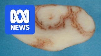 Potato exports from Tasmania to Victoria, NSW, SA restricted due to mop-top virus detections at eight Tasmanian farms