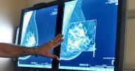 Louisiana is 16th-highest for Medicare mammogram screenings in the U.S. See parish data.