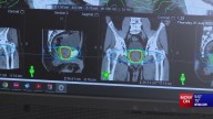 New technology helps pinpoint and personalize radiation for cancer patients