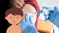 Aumentan casos de sarampión en México: quiénes deben de aplicarse la vacuna y a dónde acudir