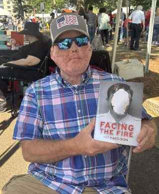 Pat Hardison, Mississippi’s first face transplant survivor, tells a story of fear, faith and a second chance
