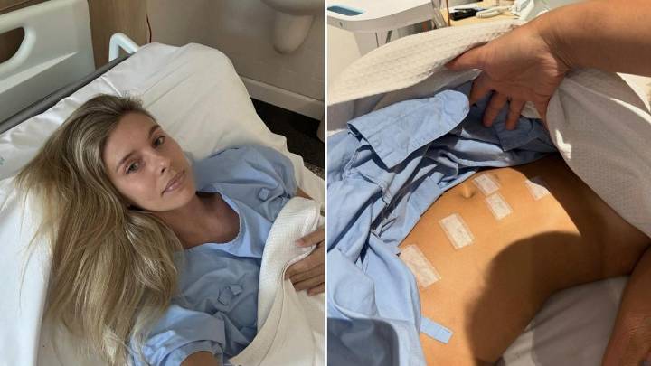 Aussie model Natasha Oakley reveals she had cancerous tumour and part of kidney removed