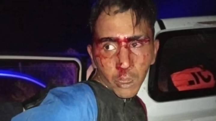 Justicia por mano propia: vecinos de La Rinconada desfiguran a golpes a un presunto ladrón