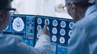Del mito a la realidad: la IA comienza a leer recuerdos humanos en un laboratorio