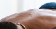 Acupuncture proves to be safe and effective for chronic back pain