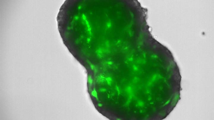 Un avance internacional liderado por el Centro de Investigación del Cáncer abre nuevas vías terapéuticas para el colangiocarcinoma