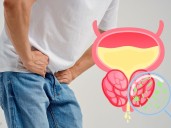 Cáncer de próstata en México: 1 hombre muere cada 15 minutos, ¿podemos cambiarlo?