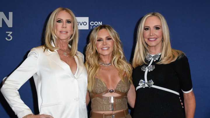 What These Real Housewives Stars Looked Like Before Plastic Surgery