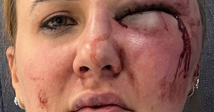 'My boyfriend left me looking like this, and was in jail for just two months'