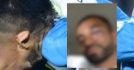 Rodrigo Aguirre muestra su inflamado ojo, un día después del terrible choque en pleno partido