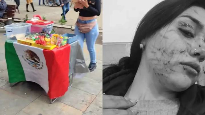 Transmisión en vivo terminó mal: emprendedora fue desfigurada por otra mujer en el centro de Bogotá