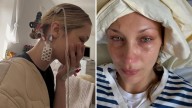 Bella Hadid in hospital for treatment of Lyme disease