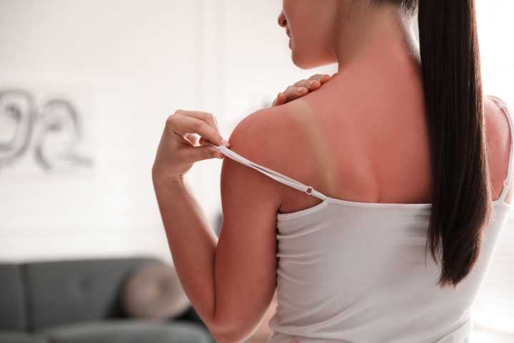 Sharp Rise in Sun Damage Reveals Dangerous Disconnect Between Belief and Behavior