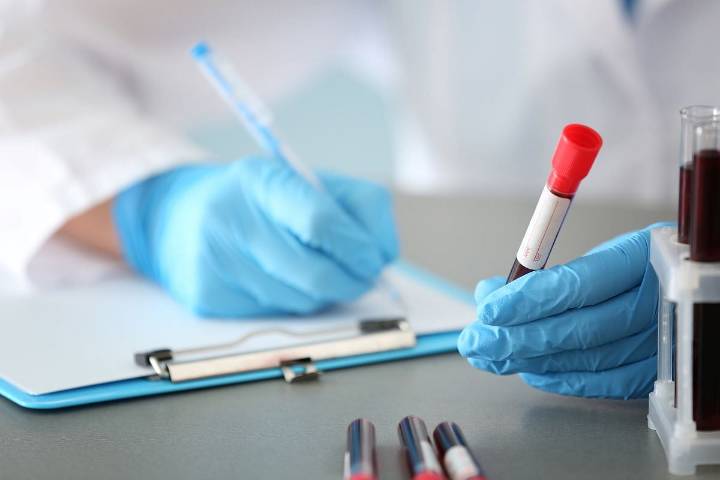 Hospitals Vary in Their Definition of Blood Culture Contamination