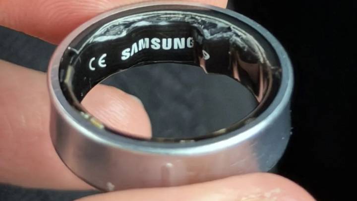 Samsung Galaxy Ring owner reportedly hospitalized after it swells — 'won’t be wearing a smart ring ever again'