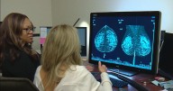 Colorado clinics roll out new imaging software to detect cancer in dense breast tissue, impacting 50% of women