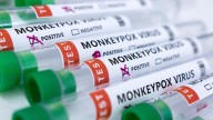 OMS levanta emergencia internacional por viruela del mono
