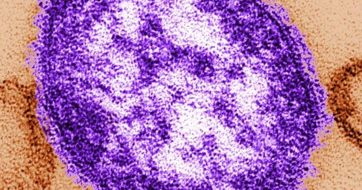 1,000 Virginians exposed to measles in most recent case