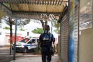 Una mujer pierde los brazos y las piernas tras el ataque de su propio perro en Francia