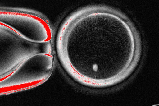 Researchers turn human skin cells into eggs -