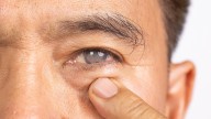 Is Your Favorite Snack Destroying Your Eyes? Experts Warn of Silent Cataract Risk