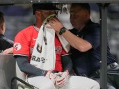 Fry has broken nose, facial fractures after hit by pitch