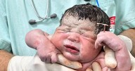 Newborn baby holds contraceptive coil that stopped mum from getting pregnant
