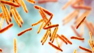 NCDHHS confirms case of tuberculosis at Raleigh high school
