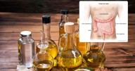 Hay una relación entre el aceite de cocina y el aumento del cáncer de colon, ¿lo sabías?