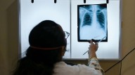 This country’s government vowed to eliminate TB by the end of 2025. It’s not going well.