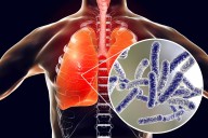 2 Dead, Dozens Sickened in Legionnaires' Outbreak in New York City Suburb