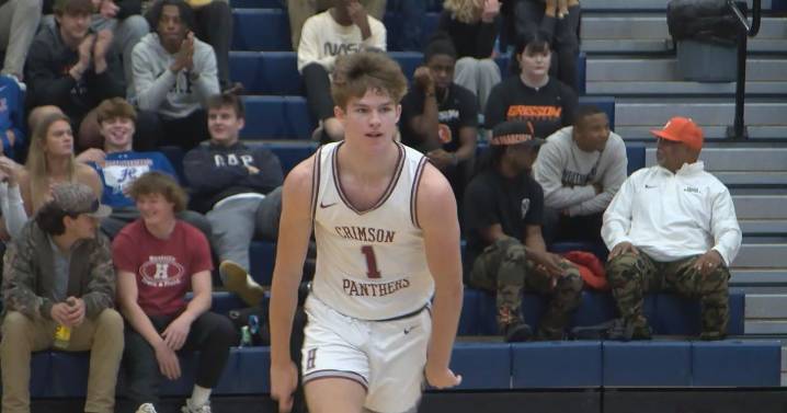 Auburn freshman guard Simon Walker undergoes successful foot surgery