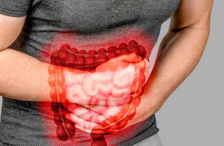 El Síndrome de Colon Irritable - La Tribuna Hispana USA