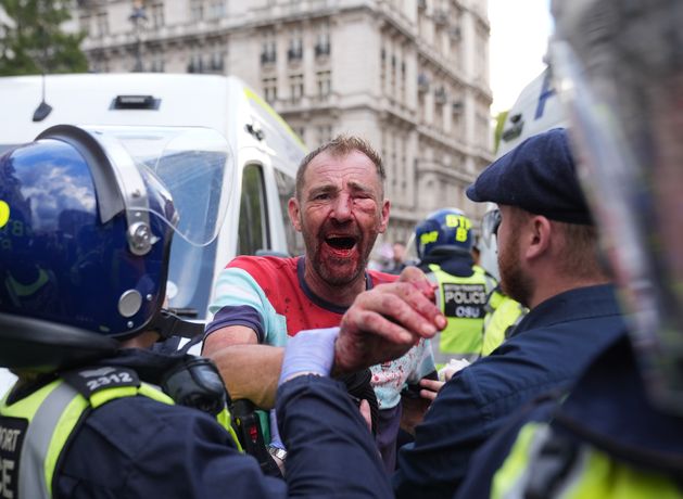 Police ‘assaulted’ and face ‘aggression’ from Tommy Robinson protesters