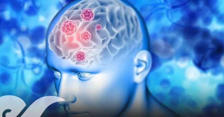 Vinculan contaminación del aire con mayor riesgo de demencia tipo Lewy