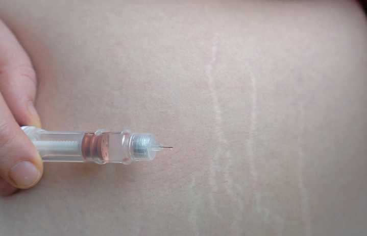 FDA Approves First Subcutaneous Version of Keytruda for Adults With Most Solid Tumors