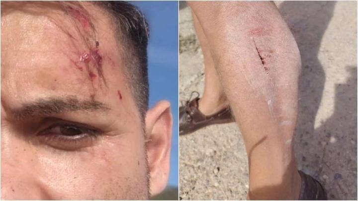 Insólito: dos pastores agreden a dos periodistas de À Puntque mientras informaban sobre el peligro de las cinco vacas perdidas en Alcalà de Xivert (Castellón)