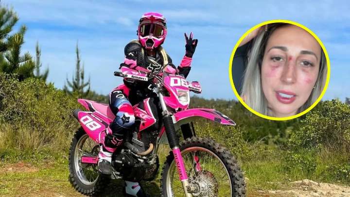 "Pensé que había muerto": Rebeca Naranjo sufre aparatoso accidente y Nano Calderón le pide que venda su moto
