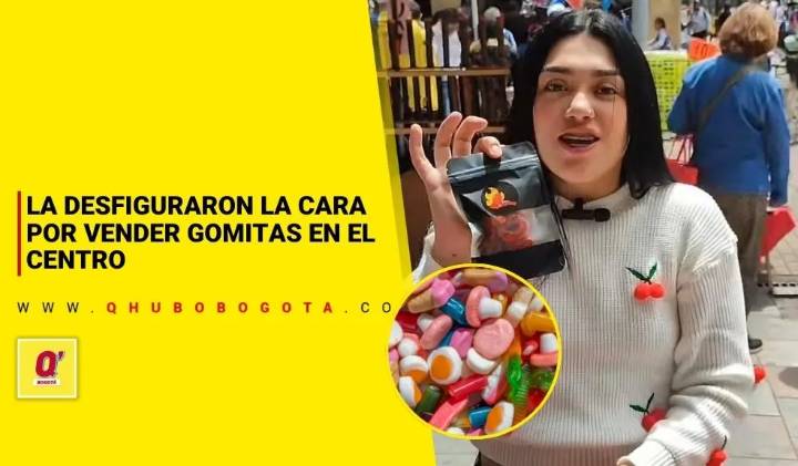 Por vender gomitas en la carrera Séptima, joven fue gravemente herida en su rostro