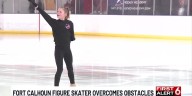 Fort Calhoun figure skater thriving despite limb difference