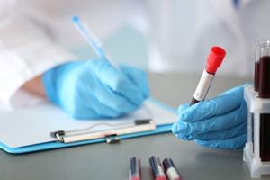 Researchers: Too Soon To Tell If ‘Liquid Biopsies’ Help More Than Harm In Cancer Screening
